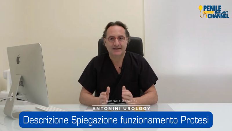 8 Testimonianza di Romeo, dopo un intervento Protesi Peniena